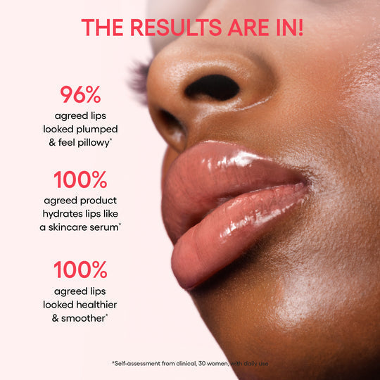 Gloss That Heals – Donut-Inspired Lip Therapy from Korea